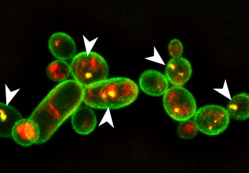 Identifican la molécula de una bacteria capaz de eliminar hongos y nemátodos en varios cultivos